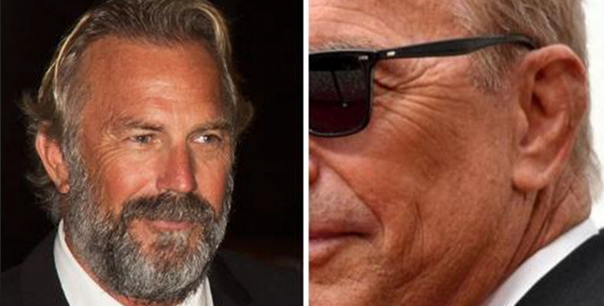 what happened to kevin costner's left ear