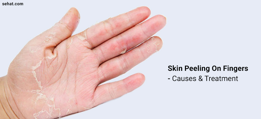 what is the skin between your fingers called