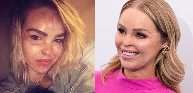 katie piper before acid attack